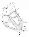 Fig. 01 - Devices and methods for minimally-invasive surgical procedures