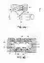 Fig. 04 - Alignment plate apparatus and method of use