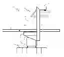 Fig. 01 - Robotic surgical system with patient support