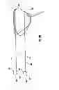 Fig. 19 - Drive system for tissue repair