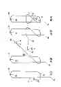 Fig. 25 - Drive system for tissue repair