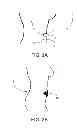 Fig. 03 - Umbilical splint and method of use