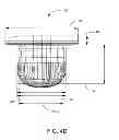 Fig. 08 - Umbilical splint and method of use