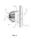 Fig. 09 - Umbilical splint and method of use