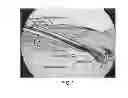 Fig. 02 - COMPOSITE IMPLANT