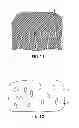 Fig. 05 - COMPOSITE IMPLANT
