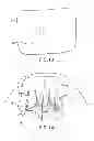 Fig. 06 - COMPOSITE IMPLANT