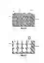 Fig. 12 - COMPOSITE IMPLANT