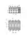 Fig. 13 - COMPOSITE IMPLANT