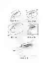 Fig. 35 - Methods, instruments and devices for extragastric reduction of stomach volume