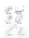 Fig. 43 - Methods, instruments and devices for extragastric reduction of stomach volume