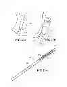Fig. 46 - Methods, instruments and devices for extragastric reduction of stomach volume