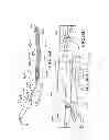 Fig. 53 - Methods, instruments and devices for extragastric reduction of stomach volume