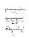 Fig. 69 - Methods, instruments and devices for extragastric reduction of stomach volume