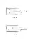 Fig. 06 - Gastrointestinal implant and methods for use
