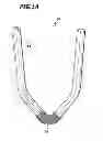 Fig. 02 - Surgical clip device
