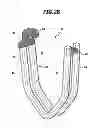 Fig. 05 - Surgical clip device