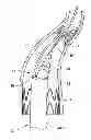Fig. 01 - Retrieval Catheters and Methods of Retrieving Deployed Medical Devices