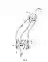 Fig. 07 - Retrieval Catheters and Methods of Retrieving Deployed Medical Devices