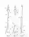 Fig. 09 - Retrieval Catheters and Methods of Retrieving Deployed Medical Devices