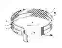 Fig. 01 - Method and apparatus for tensile colonoscopy compression