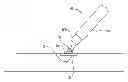 Fig. 01 - Instrument and methods for surgically closing percutaneous punctures