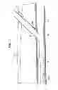 Fig. 02 - Instrument and methods for surgically closing percutaneous punctures