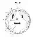 Fig. 08 - Instrument and methods for surgically closing percutaneous punctures