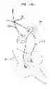 Fig. 22 - Instrument and methods for surgically closing percutaneous punctures