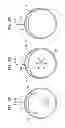 Fig. 40 - Instrument and methods for surgically closing percutaneous punctures