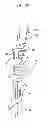 Fig. 45 - Instrument and methods for surgically closing percutaneous punctures