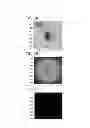 Fig. 03 - Symmetry based air pocket detection methods and systems