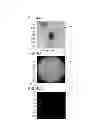 Fig. 05 - Symmetry based air pocket detection methods and systems