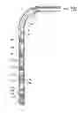 Fig. 01 - Method and apparatus for wellbore fluid treatment
