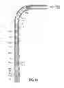 Fig. 02 - Method and apparatus for wellbore fluid treatment