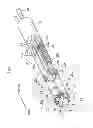 Fig. 05 - ENDOSCOPE