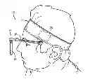 Fig. 01 - HEADBAND MOUNTED REARVIEW MIRROR