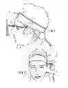 Fig. 02 - HEADBAND MOUNTED REARVIEW MIRROR