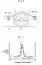 Fig. 02 - Sound reproduction device
