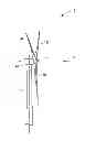 Fig. 01 - SYSTEM FOR DETECTING AND CONTROLLING LOADS IN A WIND TURBINE SYSTEM