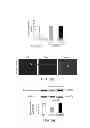 Fig. 07 - Methods of treating cerebral amyloid angiopathy