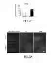 Fig. 08 - Methods of treating cerebral amyloid angiopathy