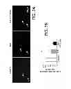 Fig. 10 - Methods of treating cerebral amyloid angiopathy