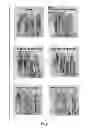 Fig. 02 - Methods and compositions for promoting hair growth