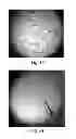 Fig. 45 - Methods and compositions for cell-proliferation-related disorders