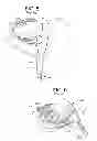Fig. 06 - Automatic club setting and ball flight optimization