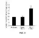 Fig. 03 - Methods for treating Parkinson's disease using pro-neurogenic compounds