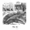 Fig. 22 - Methods for treating Parkinson's disease using pro-neurogenic compounds