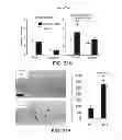 Fig. 32 - Methods for treating Parkinson's disease using pro-neurogenic compounds