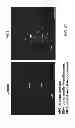 Fig. 48 - Methods for treating Parkinson's disease using pro-neurogenic compounds
